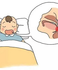 ���Ӽ�鷢�ֱ������״� ������80% ���Ƽ���ҽ�����ĵ�ҽ��