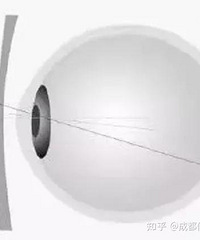 С���ӽ����۾�Ҫ��Ҫһֱ���ţ� ��Щ��˵Ҫ����һֱ���ţ���