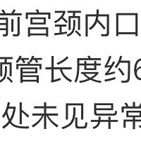 һ��Ҫ�����ڲ鹬������ ��ֱ�ӱ�����סԺ ��̥ʮ����