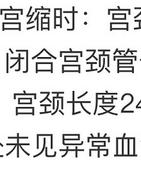 һ��Ҫ�����ڲ鹬������ ��ֱ�ӱ�����סԺ ��̥ʮ����