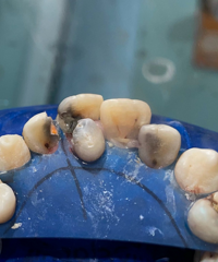 ��Ҫ�ú��Ӻ�̼�������ˣ�����������̫�����ˣ�