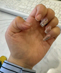 �Ļ�ɴ�ղ�Ҫ�������� ��һֱ����