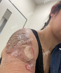 ���������ж�ݣ��������� ��������ˮֱ���������ϵ�