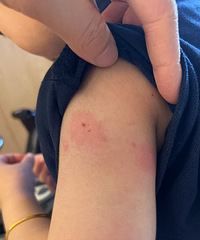 ���ڵ�������ô��ô���������ӵ��ֱ۱�ҧ��һ����Ϳ