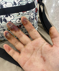奉劝想自己做美缝的朋友停止!不然手会烂掉!