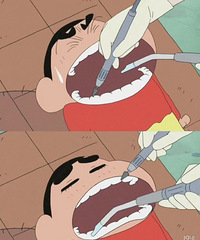 ���ӿ�����ȥ����