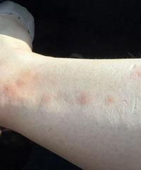 ���ó�������˲���ʲô���õıȽϺã�