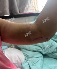 ƽ��ĳ����԰�������Ƥ���º���ˤ�����ۣ�԰�����ҳ���ܲ���