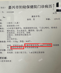 Mlema�ںϲ����ϰ����ڲ������������ߣ�С�����˻�������