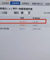 ������������30�����������˸�ʹ4Сʱ����ICU��