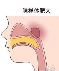 [����]Ϊɶ���ڵ�С����������ʴ���ô�ձ飿ҽԺ�ö�...