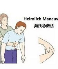 "过节饮食需注意!老人吃年糕被噎 呼吸心跳停止达半小"