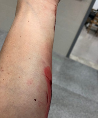 车库地面积水导致女业主受伤,物业上:墙有没有被撞坏