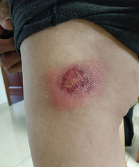 ײ�����˵�˾�� ���������