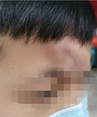 ����Сѧ�ſڷ�������һĻҪע�⣡