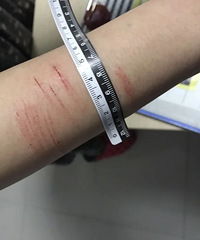 �ٰ�Ů����ҹֱ���ԲУ�ԭ����ɽ���