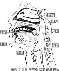 "打呼噜搞不好会要人命的 睡眠呼吸综合症你有没有?(图解)"