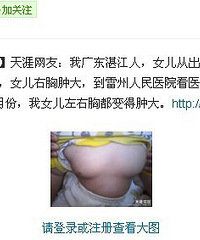 "几个月大宝宝吃了奶粉,胸部大的不行,都超过大人了,有图"