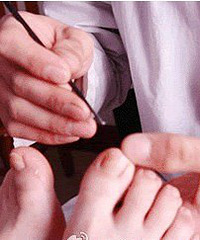 修脚可能会患上乙肝、梅毒、艾滋病 大家要小心