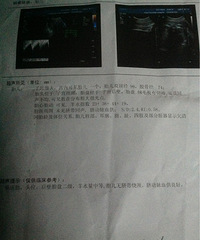 "(红黄蓝孕妈日记)胎心监护回来"