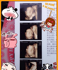 【红黄蓝孕妈日记】到32周刚好10斤