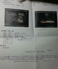 【红黄蓝孕妈日记】之初八忌求医?