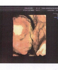 【红黄蓝孕妈日记】+小肉肉7个月拉,预产期5月份~