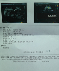 【红黄蓝孕妈日记】+入盆?还可以!