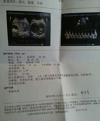 【红黄蓝孕妈日记】之看B超还是晚点出来吧