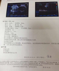 红黄蓝孕妈日记 我要被拉去“宰”啦