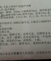 "四维彩超归来,大家帮我看看呗"