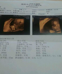 "【孕妈日记】90后惶恐的妈妈"