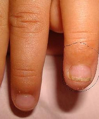 [����]ָ�����а׵� ����˵�ǻ׳�