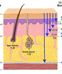 [����]��Щ�� ��ϴ���ˮ�¿��ܵ�����