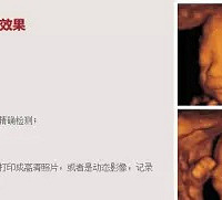 "原来做四维这么坑爹的,“排畸”其实二维就可以做到了!"