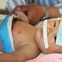 [����]�̶�2���Ӻ��ӵ����˱��ı�