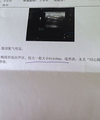 "请教,依图中B超报告单所说,严重吗?"