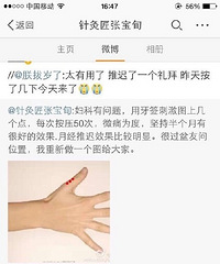 ̫������ ��������׼��