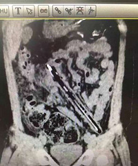 С���ѱʲ���˸���