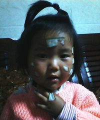 ���֮����Ĥ