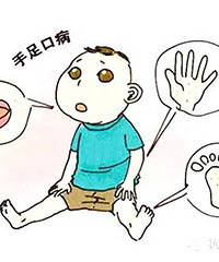 "手足口病、疱疹性咽峡炎进入高发期——重视"