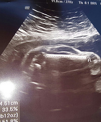 �����Ż��ˡ�������׼�����B��ͼ�ﾪ�֡�һ��С������