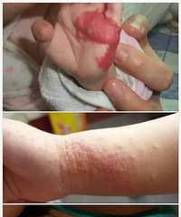 [����]̥��Ӧ����ôԤ��