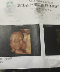 【漾子亲水馆杯·孕妈日记】好捉急 名字还没想好