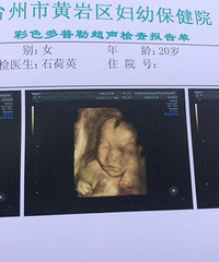 都说我家宝宝肉肉的