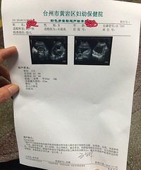 【漾子亲水馆·孕妈日记】我要报道 孕18周