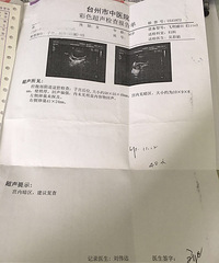 ��������ˮ�ݱ��������ռǡ�+���˴��ֲ����Ķ�̥