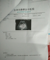 ��������ˮ�ݱ��������ռǡ�����Ķ�̥