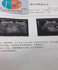 【漾子亲水馆杯·孕妈日记】+ 头胎 边学边等待娃的到来