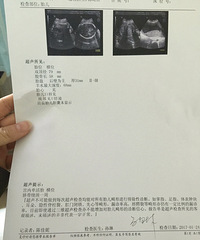 �ȴ�һ�������������Ĳ����ס�